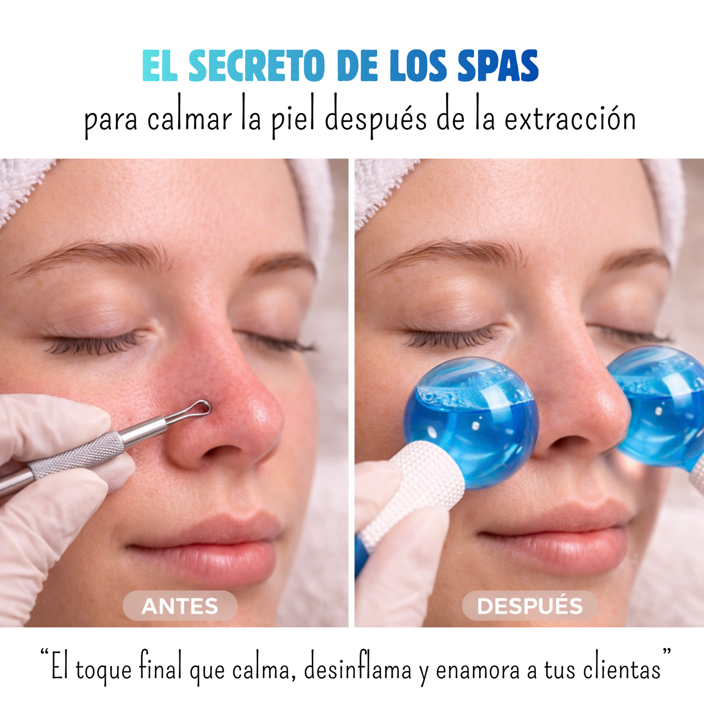 Kit Facial Ice Glow
